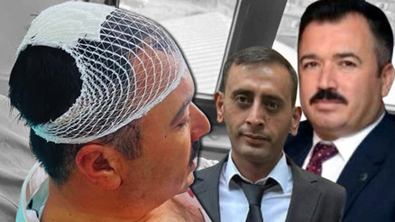 Belediye başkan yardımcısını şekerlikle yaraladı İl başkan yardımcısı tutuklandı
