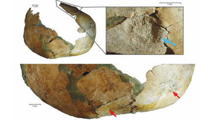 Tıp tarihine ışık tutan keşif