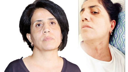 Sabiha’nın şiddet kabusu... Çocuğu olmuyor diye darp edildi Sabiha’nın şiddet kabusu... Çocuğu olmuyor diye darp edildi