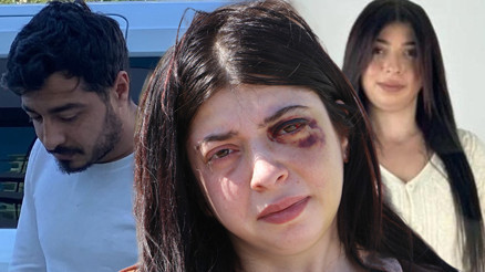 Sokak ortasında dehşeti yaşamıştı: Yüzümde bir demirle sonsuza dek yaşamaya mahkum bırakıldım Sokak ortasında dehşeti yaşamıştı: Yüzümde bir demirle sonsuza dek yaşamaya mahkum bırakıldım