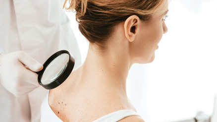 37 şehirde cilt kanseri taraması