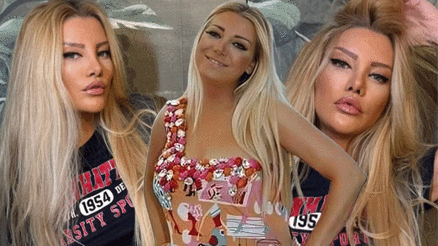 Gülşah Saraçoğlunu sevenleri tanımakta zorlandı Estetik operasyonundan 13 gün sonra makyajlı ilk poz Gülşah Saraçoğlunu sevenleri tanımakta zorlandı Estetik operasyonundan 13 gün sonra makyajlı ilk poz