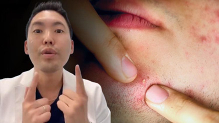 Uzmanı uyardı: Sivilcenizdeki gözden kaçan bu belirtiler kanser olabilir Uzmanı uyardı: Sivilcenizdeki gözden kaçan bu belirtiler kanser olabilir