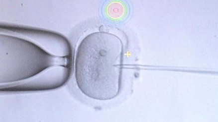Kısırlık oranları artıyor Uzmanlar başlıca nedenlerini açıkladı, her gün kullanıyoruz
