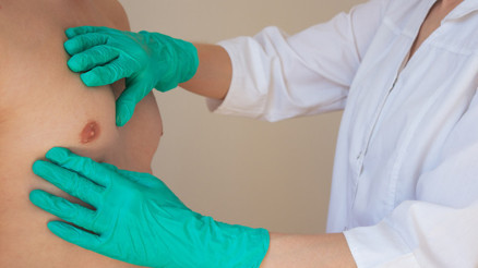 Bu hastalık kadınlara özgü sanıyordu, hiç beklemediği anda onu da buldu Erkeklerde meme kanseri hakkındaki gerçekler… ‘Geç saptanıyor, sağkalım oranı daha düşük’