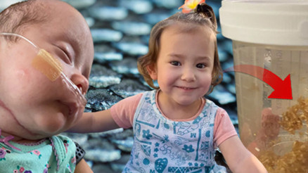 Prematüre doğdu, 131 gün yoğun bakımda kaldı. Hayatını balık derisi tedavisi kurtardı | Ona küçük denizkızım diyorum