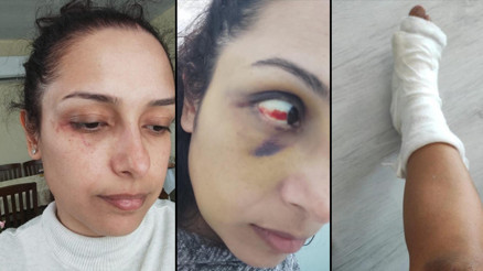 Adanada genç öğretmenin hayatı kabusa döndü Hamileyken dövdü, ayağım kırıldı, bebeğimi kaçırdı