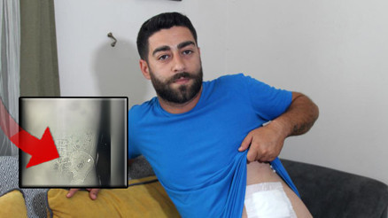 Karnında hissettiği ağrıyla hastaneye gitti, gerçek çekilen röntgenle ortaya çıktı Karnında hissettiği ağrıyla hastaneye gitti, gerçek çekilen röntgenle ortaya çıktı