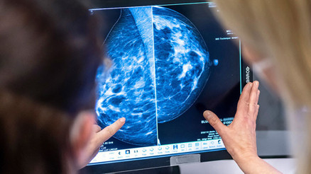 Charite Hastanesinden kanser teşhisinde devrim