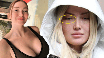 Estetik operasyonları için ne kadar harcadı Danla Bilic ilk kez açıkladı