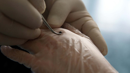 Kene bir can daha aldı Acı haber Çorumdan geldi