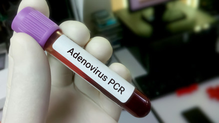 Adenovirüs nedir, belirtileri neler, nasıl bulaşır Tolgahan Sayışman uyardı: “10 gündür mücadele veriyoruz. Çocuklarınıza dikkat edin.” Adenovirüs nedir, belirtileri neler, nasıl bulaşır Tolgahan Sayışman uyardı: “10 gündür mücadele veriyoruz. Çocuklarınıza dikkat edin.”