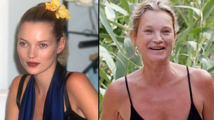 Hızlı hayatın izleri yüzünde gizli