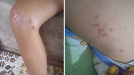 Denizden çıkan çocuk bir anda fenalaştı, korkunç gerçek muayenede öğrenildi | İğrenç görüntüye tepki yağdı Denizden çıkan çocuk bir anda fenalaştı, korkunç gerçek muayenede öğrenildi | İğrenç görüntüye tepki yağdı