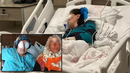 Şizofreni hastası kadın, 5 yıl sonra başka bir hastanın daha gözlerini oydu