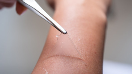 Sakın bunu yapmayın Agresif işlemlerden uzak durun Yaz mevsimi bakımlarında yeni trendler neler