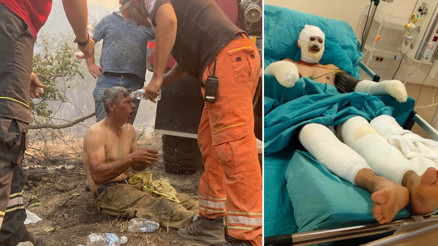 Yanıyorum, su verin feryatlarıyla yürekleri dağlamıştı Orman işçisi Kader Derelinin son hali paylaşıldı