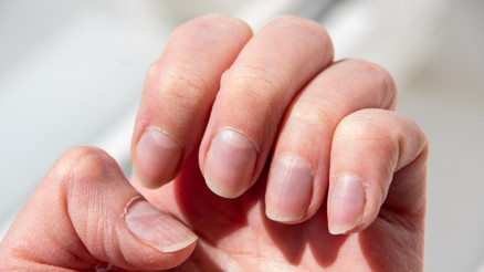 Sağlıklı cilt ve güçlü tırnaklar için bilmeniz gerekenler