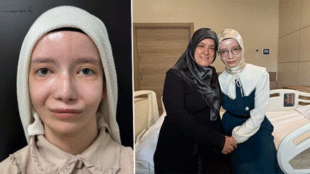 Bu rahatsızlığın adı Moebius sendromu... Doğuştan kullanamıyordu 23 yıl sonra kavuştu: “Sürekli aynaya bakar oldum”