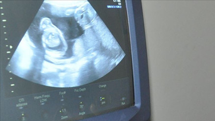 Kürtaj yasağına mahkeme desteği