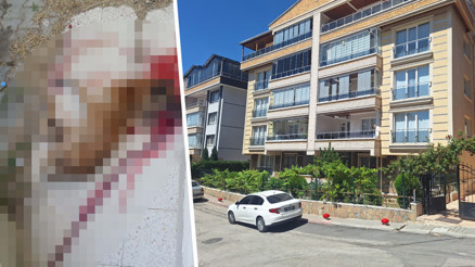 Ankarada polis, sokak köpeğini tabancayla vurarak öldürdü Kendisine saldırdığını iddia etti