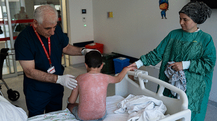 Küçük çocuk 4 saat güneşte kaldı hastanelik oldu