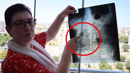 Hastanede hayatının şokunu yaşadı 22 yıldır karnında: Canlı bomba gibi geziyorum