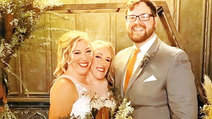 Doktorlar ‘Yaşamaları imkansız’ demişti… 35 yaşındaki yapışık ikizlerin çocuğu oldu Doktorlar ‘Yaşamaları imkansız’ demişti… 35 yaşındaki yapışık ikizlerin çocuğu oldu