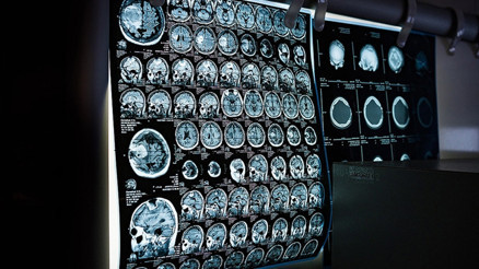 Sağlık Bakanlığından yeni uygulama: Ücretsiz kanser taramaları için SMS ile bilgilendirme dönemi başladı