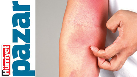 Renkli, sulu, alerjik