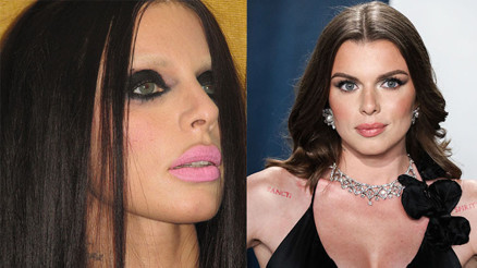 ‘Keşke eski halime geri dönebilsem’ Estetiklerden sonra bambaşka birine dönüşmüştü… Erkekler uğruna yaptıklarından pişman oldu