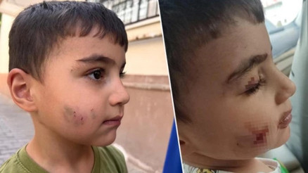 Ankara’da evde uyuyan küçük çocuğu lağım faresi ısırdı