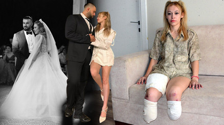 Evlilik yıl dönümünde hayatı karardı: Genç kadın bacaklarını kaybetti