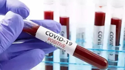 Covid-19 vakaları yeniden artışa geçti Omicron varyantının alt tipleri yaygınlaşıyor