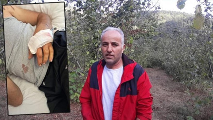 Ayının saldırısına uğrayan çiftçi dehşet anlarını anlattı: “Parmağımı kopardı” Ayının saldırısına uğrayan çiftçi dehşet anlarını anlattı: “Parmağımı kopardı”