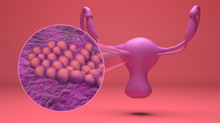 Her kadın 21 yaşından sonra bu testi mutlaka yaptırmalı Dünyada her yıl yaklaşık 1.5 milyon kadın jinekolojik kanserle mücadele ediyor
