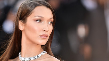 Bella Hadidin hastalığı nedir, bulaşıcı mı Lyme hastalığı belirtileri nelerdir, neden olur, tedavisi nasıl yapılıyor Bella Hadidin hastalığı nedir, bulaşıcı mı Lyme hastalığı belirtileri nelerdir, neden olur, tedavisi nasıl yapılıyor