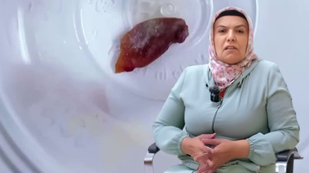 1 buçuk yıldır öksürüyordu, hastanedeki kontrolde şoke eden gerçek ortaya çıktı