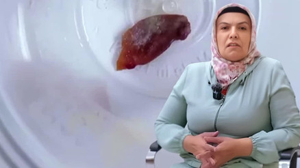 1 buçuk yıldır öksürüyordu, hastanedeki kontrolde şoke eden gerçek ortaya çıktı