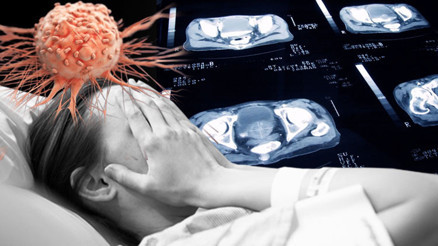 Küresel kanser patlaması yaşanacak 2050ye kadar ölümlerin %75 artması bekleniyor... Türkiye’de durum ne