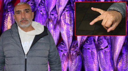 Balıkçıyla kavga eden müşteri çuprayla dövüldü, eli kırıldı Balıkçıyla kavga eden müşteri çuprayla dövüldü, eli kırıldı