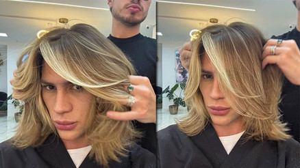 Daha 31 yaşındaydı… Ünlü fenomen ‘tilki gözü’ operasyonundan sonra hayatını kaybetti