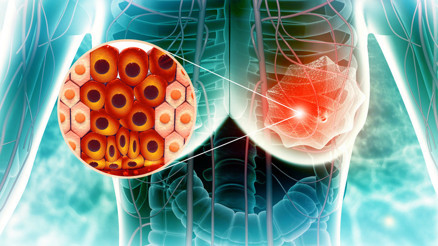 Sağlıklı yaşamın meme sağlığına etkisi