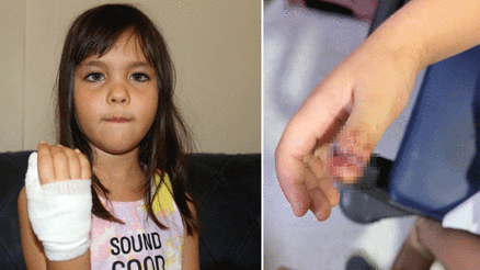 Antalyada anaokulunda korkunç olay 4 yaşındaki çocuğun parmağı, demir kapıya sıkışarak koptu