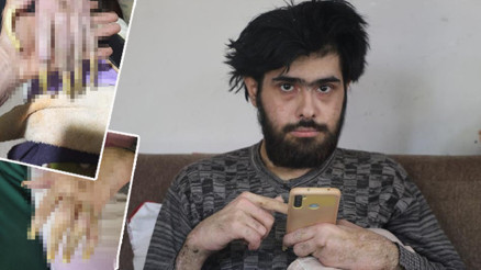 3 yıldır evden dışarı çıkmıyor Depremden sonra bu hale geldi | Sadece telefonla oynuyor: Elimde olsa tuvalete de gitmem yemek de yemem