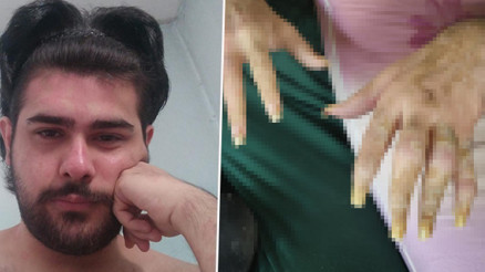 3 yıldır evden dışarı çıkmıyor, tırnaklarını kesmiyordu Eski hali ortaya çıktı | Arkadaşı Barışın değişimini anlattı