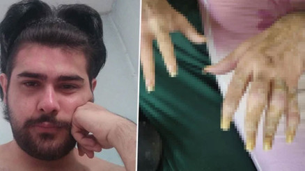 3 yıldır evden dışarı çıkmıyor, tırnaklarını kesmiyordu Eski hali ortaya çıktı