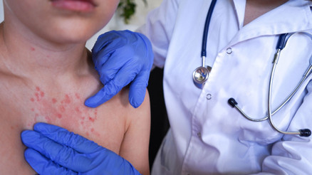 Alerji sanmıştı, gerçek çok farklı çıktı: ‘Tüm ailem etkilendi | Herkes risk altında