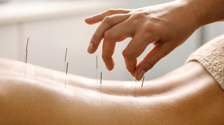 MS hastalarına akupunktur tedavisi MS hastalarına akupunktur tedavisi