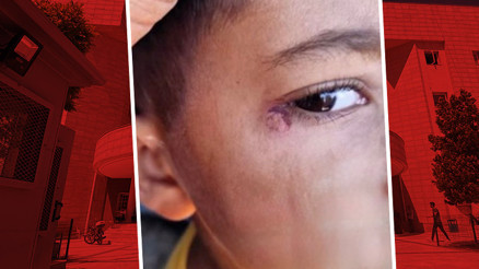 Okulun temizlik görevlisi, 7 yaşındaki çocuğun yüzünde sigara söndürdü